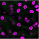 Top: Normal cells from a mouse kidney prior to cooling show the microtubule structure is intact. Middle: After 24 hours at 4 degrees C and rewarming, the microtubule structure has disappeared. Top: The microtubule structure in the cells pretreated with the drug combination before cooling and rewarming closely resemble that of normal cells.
